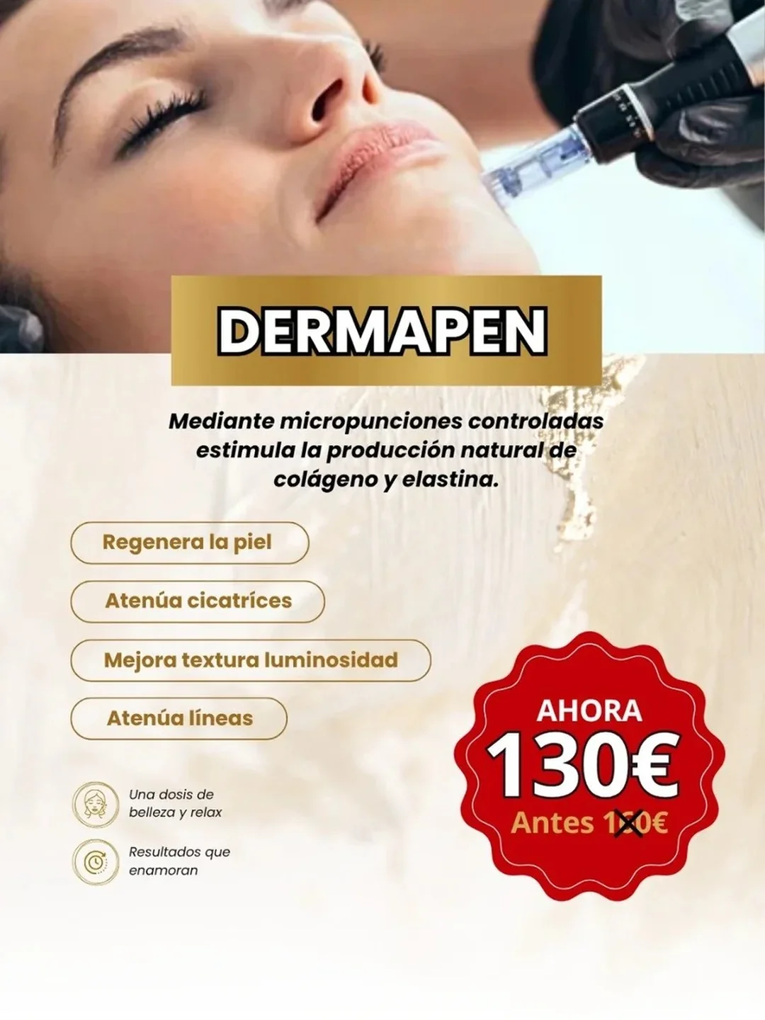Tratamiento Dermapen